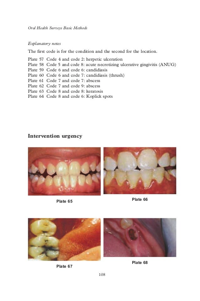 Who oralhealthsurveysbasicmethods5thedition2013
