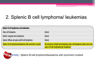 2. Splenic B cell lymphoma/ leukemias
New Entity : Splenic B-cell lymphoma/leukaemia with prominent nucleoli
 