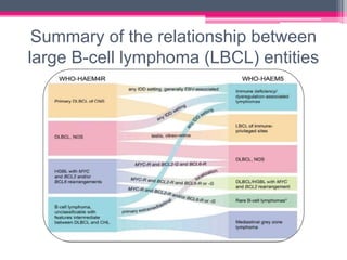 Summary of the relationship between
large B-cell lymphoma (LBCL) entities
 