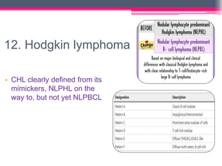 12. Hodgkin lymphoma
• CHL clearly defined from its
mimickers, NLPHL on the
way to, but not yet NLPBCL
 