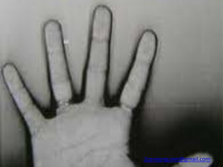 iiii




       1connorquinn@gmail.com
 