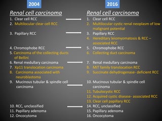 Renal cell carcinoma
1. Clear cell RCC
2. Multilocular clear cell RCC
3. Papillary RCC
4. Chromophobe RCC
5. Carcinoma of the collecting ducts
of Bellini
6. Renal medullary carcinoma
7. Xp11 translocation carcinoma
8. Carcinoma associated with
neuroblastoma
9. Mucinous tubular & spindle cell
carcinoma
10. RCC, unclassified
11. Papillary adenoma
12. Oncocytoma
Renal cell carcinoma
1. Clear cell RCC
2. Multilocular cystic renal neoplasm of low
malignant potential
3. Papillary RCC
4. Hereditary leiomyomatosis & RCC –
associated RCC
5. Chromophobe RCC
6. Collecting duct carcinoma
7. Renal medullary carcinoma
8. MiT family translocation RCC
9. Succinate dehydrogenase- deficient RCC
10. Mucinous tubular & spindle cell
carcinoma
11. Tubulocystic RCC
12. Acquired cystic disease- associated RCC
13. Clear cell papillary RCC
14. RCC, unclassified
15. Papillary adenoma
16. Oncocytoma
2004 2016
 