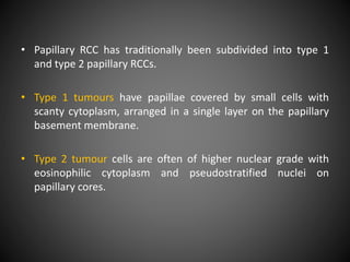 • Papillary RCC has traditionally been subdivided into type 1
and type 2 papillary RCCs.
• Type 1 tumours have papillae covered by small cells with
scanty cytoplasm, arranged in a single layer on the papillary
basement membrane.
• Type 2 tumour cells are often of higher nuclear grade with
eosinophilic cytoplasm and pseudostratified nuclei on
papillary cores.
 