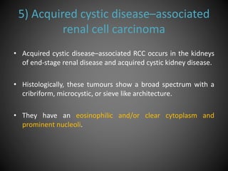 5) Acquired cystic disease–associated
renal cell carcinoma
• Acquired cystic disease–associated RCC occurs in the kidneys
of end-stage renal disease and acquired cystic kidney disease.
• Histologically, these tumours show a broad spectrum with a
cribriform, microcystic, or sieve like architecture.
• They have an eosinophilic and/or clear cytoplasm and
prominent nucleoli.
 