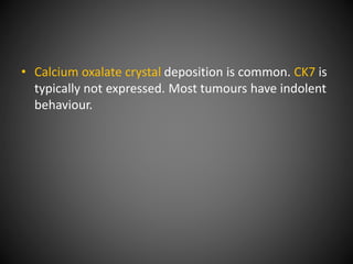 • Calcium oxalate crystal deposition is common. CK7 is
typically not expressed. Most tumours have indolent
behaviour.
 