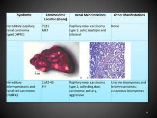 Syndrome Chromosome
Location (Gene)
Renal Manifestations Other Manifestations
Hereditary papillary
renal carcinoma
type1(HPRC)
7q31
MET
Papillary renal carcinoma
type 1: solid, multiple and
bilateral
None
Hereditary
leiomyomatosis and
renal cell carcinoma
(HLRCC)
1q42-43
FH
Papillary renal carcinoma
type 2, collecting duct
carcinoma: solitary,
aggressive
Uterine leiomyomas and
leiomyosarcomas;
cutaneous leiomyomas
9
 