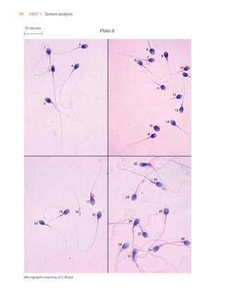 86      PART I Semen analysis


     10 microns
                                         Plate 8




     Micrographs courtesy of C Brazil.
 
