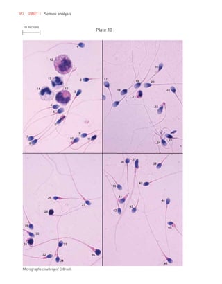 90   PART I Semen analysis


 10 microns
                                     Plate 10




 Micrographs courtesy of C Brazil.
 