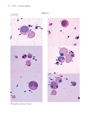 96     PART I Semen analysis



                                         Plate 13
     15 microns




     Micrographs courtesy of C Brazil.
 