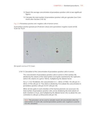 CHAPTER 2 Standard procedures 105



              12. Report the average concentration of peroxidase-positive cells to two signiﬁcant
                  ﬁgures.

              13. Calculate the total number of peroxidase-positive cells per ejaculate (see Com-
                  ments after Section 2.18.1.8).

Fig. 2.14 Peroxidase-positive and -negative cells in human semen

A peroxidase-positive granulocyte (P) (brown colour) and a peroxidase-negative round cell (N).
Scale bar 10 Pm.




Micrograph courtesy of TG Cooper.



       2.18.1.5 Calculation of the concentration of peroxidase-positive cells in semen

              The concentration of peroxidase-positive cells in semen is their number (N)
              divided by the volume of the total number (n) of grids examined for the replicates
              (where the volume of a grid is 100 nl), multiplied by the dilution factor.

              For a 1 + 9 (1:10) dilution, the concentration is C = (N/n) × (1/100) × 10 cells per nl =
              (N/n) × (1/10) cells per nl. Thus (N/n) is divided by 10 to obtain the concentration in
              peroxidase-positive cells per nl (106 cells per ml).

              When all nine grids in each chamber of the haemocytometer are assessed, the
              total number of peroxidase-positive cells can be divided by the total volume of
              both chambers (1.8 Pl), and multiplied by the dilution factor (10), to obtain the con-
              centration in cells per Pl (thousand cells per ml).


                Note: This procedure can be used to calculate round cell concentration when the
                total number of round cells counted (peroxidase-positive and -negative) is used for
                N in the calculation.
 