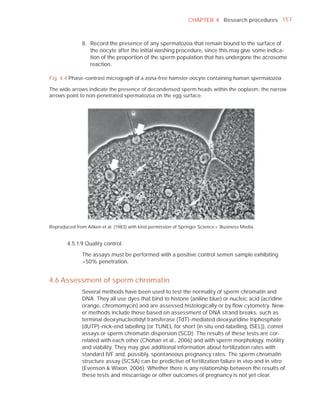 CHAPTER 4 Research procedures 157



               8. Record the presence of any spermatozoa that remain bound to the surface of
                  the oocyte after the initial washing procedure, since this may give some indica-
                  tion of the proportion of the sperm population that has undergone the acrosome
                  reaction.

Fig. 4.4 Phase-contrast micrograph of a zona-free hamster oocyte containing human spermatozoa

The wide arrows indicate the presence of decondensed sperm heads within the ooplasm; the narrow
arrows point to non-penetrated spermatozoa on the egg surface.




Reproduced from Aitken et al. (1983) with kind permission of Springer Science + Business Media.


        4.5.1.9 Quality control

               The assays must be performed with a positive control semen sample exhibiting
               >50% penetration.


4.6 Assessment of sperm chromatin
               Several methods have been used to test the normality of sperm chromatin and
               DNA. They all use dyes that bind to histone (aniline blue) or nucleic acid (acridine
               orange, chromomycin) and are assessed histologically or by ﬂow cytometry. New-
               er methods include those based on assessment of DNA strand breaks, such as
               terminal deoxynucleotidyl transferase (TdT)-mediated deoxyuridine triphosphate
               (dUTP)-nick-end labelling (or TUNEL for short (in situ end-labelling, ISEL)), comet
               assays or sperm chromatin dispersion (SCD). The results of these tests are cor-
               related with each other (Chohan et al., 2006) and with sperm morphology, motility
               and viability. They may give additional information about fertilization rates with
               standard IVF and, possibly, spontaneous pregnancy rates. The sperm chromatin
               structure assay (SCSA) can be predictive of fertilization failure in vivo and in vitro
               (Evenson & Wixon, 2006). Whether there is any relationship between the results of
               these tests and miscarriage or other outcomes of pregnancy is not yet clear.
 