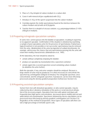 168 PART I I Sperm preparation



             5. Place a 5–10 Pl droplet of culture medium in a culture dish.

             6. Cover it with mineral oil (pre-equilibrated with CO 2 ).

             7. Introduce 5–10 Pl of the sperm suspension into the culture medium.

             8. Carefully aspirate the motile spermatozoa found at the interface between the
                culture medium and oil with an ICSI pipette.

             9. Transfer them to a droplet of viscous solution, e.g. polyvinylpyrrolidone (7–10%
                (100 g/l) in medium).


 5.8 Preparing retrograde ejaculation samples
             In some men, semen passes into the bladder at ejaculation, resulting in aspermia,
             or no apparent ejaculate. Conﬁrmation of this situation is obtained by examining
             a sample of post-ejaculatory urine for the presence of spermatozoa. If pharmaco-
             logical treatment is not possible or not successful, spermatozoa may be retrieved
             from the urine. Alkalinization of the urine by ingestion of sodium bicarbonate, for
             example, will increase the chance that any spermatozoa passing into the urine will
             retain their motility characteristics (Mahadevan et al., 1981).

             At the laboratory, the man should be asked to:
             y urinate without completely emptying the bladder;
             y produce an ejaculate by masturbation into a specimen container;
             y urinate again into a second specimen vessel containing culture medium
               (to alkalinize the urine further).

             Both the ejaculate, if any, and urine samples should be analysed. Because a
             large volume of urine may be produced, it is often necessary to concentrate the
             specimen by centrifugation (500g for 8 minutes) The retrograde specimen, once
             concentrated, and the antegrade specimen, if produced, can be most effectively
             processed using the density-gradient preparation method (see Section 5.5).


 5.9 Preparing assisted ejaculation samples
             Semen from men with disturbed ejaculation, or who cannot ejaculate, may be
             collected by direct vibratory stimulation of the penis or rectal electrical stimula-
             tion of the accessory organs. Ejaculates from men with spinal cord injury will
             frequently have high sperm concentrations, decreased sperm motility and red and
             white blood cell contamination. Specimens obtained by electro-ejaculation can be
             processed most effectively by density-gradient centrifugation (see Section 5.5).
             Regardless of the method of preparation, these types of ejaculates will often con-
             tain a high percentage of immotile sperm cells.
 