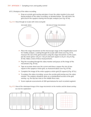 264 APPENDIX 7 Sampling errors and quality control


 A7.5.3 Analysis of the video-recording
               y Draw an acetate grid overlay and place it over the video monitor to be used
                 during analysis of the video-recording, as detailed below. This will mimic the
                 grid used in the eyepiece during microscopic analysis (see Fig. A7.4a).

 Fig. A7.4 View through an ocular with reticle (red grid)

                   (a) ocular alone                         (b) view of stage micrometer



                                                                 100     25
                                                                 µm      µm




               y Place the stage micrometer on the microscope stage at the magnification used
                 for motility analysis. Looking through the ocular with reticle (see Fig. A7.4),
                 measure the size of the grid sections using the stage micrometer. In this exam-
                 ple the reticle grid is 125 Pm × 125 Pm and each square is 25 Pm × 25 Pm (Fig.
                 A7.4b). Make a note of these measurements.
               y Play the recording through the video monitor and pause at the image of the
                 micrometer (Fig. A7.5a).
               y Tape an acetate sheet over the screen and draw a square the size of one
                 square in the eyepiece reticle grid, as measured above (see Fig. A7.5b).
               y Complete the image of the entire eyepiece reticle grid (25 squares) (Fig. A7.5c).
               y To analyse the video-recording, secure the acetate grid overlay over the video
                 monitor. The analysis should be done on a standardized section of the grid
                 overlay, e.g. the top two rows or the middle three rows.
               y Score replicate assessments of 200 spermatozoa for each recorded segment.


  Fig. A7.5 View of the videotaped image of the stage micrometer on the monitor and the drawn overlay;
          see text for explanation

                  (a)                               (b)                               (c)




                                                 25 µm
 
