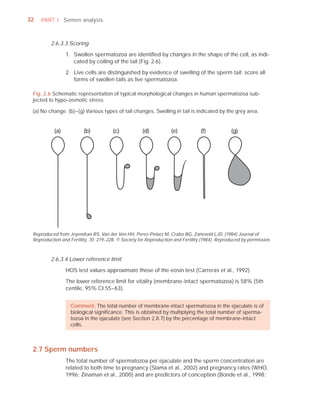 32   PART I Semen analysis



         2.6.3.3 Scoring

                 1. Swollen spermatozoa are identiﬁed by changes in the shape of the cell, as indi-
                    cated by coiling of the tail (Fig. 2.6).

                 2. Live cells are distinguished by evidence of swelling of the sperm tail; score all
                    forms of swollen tails as live spermatozoa.

 Fig. 2.6 Schematic representation of typical morphological changes in human spermatozoa sub-
 jected to hypo-osmotic stress

 (a) No change. (b)–(g) Various types of tail changes. Swelling in tail is indicated by the grey area.


           (a)           (b)           (c)            (d)          (e)            (f)           (g)




 Reproduced from Jeyendran RS, Van der Ven HH, Perez-Pelaez M, Crabo BG, Zaneveld LJD. (1984) Journal of
 Reproduction and Fertility, 70: 219–228. © Society for Reproduction and Fertility (1984). Reproduced by permission.



         2.6.3.4 Lower reference limit

                 HOS test values approximate those of the eosin test (Carreras et al., 1992).

                 The lower reference limit for vitality (membrane-intact spermatozoa) is 58% (5th
                 centile, 95% CI 55–63).


                   Comment: The total number of membrane-intact spermatozoa in the ejaculate is of
                   biological signiﬁcance. This is obtained by multiplying the total number of sperma-
                   tozoa in the ejaculate (see Section 2.8.7) by the percentage of membrane-intact
                   cells.



 2.7 Sperm numbers
                 The total number of spermatozoa per ejaculate and the sperm concentration are
                 related to both time to pregnancy (Slama et al., 2002) and pregnancy rates (WHO,
                 1996; Zinaman et al., 2000) and are predictors of conception (Bonde et al., 1998;
 
