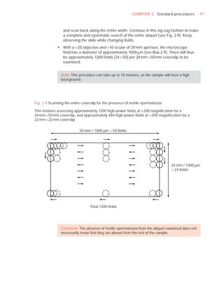 CHAPTER 2 Standard procedures          47



                 and scan back along the entire width. Continue in this zig-zag fashion to make
                 a complete and systematic search of the entire aliquot (see Fig. 2.9). Keep
                 observing the slide while changing fields.
             y With a ×20 objective and ×10 ocular of 20 mm aperture, the microscope
               field has a diameter of approximately 1000 Pm (see Box 2.9). There will thus
               be approximately 1200 fields (24 × 50) per 24 mm × 50 mm coverslip to be
               examined.


                Note: This procedure can take up to 10 minutes, as the sample will have a high
                background.




Fig. 2.9 Scanning the entire coverslip for the presence of motile spermatozoa

This involves assessing approximately 1200 high-power ﬁelds at ×200 magniﬁcation for a
24 mm × 50 mm coverslip, and approximately 484 high-power ﬁelds at ×200 magniﬁcation for a
22 mm × 22 mm coverslip.

                           50 mm / 1000 µm = 50 fields




                                                                                  24 mm / 1000 µm
                                                                                  = 24 fields




                                 Total 1200 fields




                Comment: The absence of motile spermatozoa from the aliquot examined does not
                necessarily mean that they are absent from the rest of the sample.
 