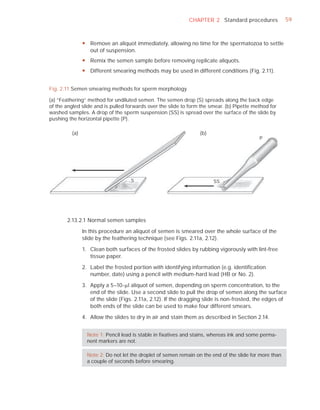 CHAPTER 2 Standard procedures              59



                y Remove an aliquot immediately, allowing no time for the spermatozoa to settle
                  out of suspension.
                y Remix the semen sample before removing replicate aliquots.
                y Different smearing methods may be used in different conditions (Fig. 2.11).


Fig. 2.11 Semen smearing methods for sperm morphology

(a) “Feathering” method for undiluted semen. The semen drop (S) spreads along the back edge
of the angled slide and is pulled forwards over the slide to form the smear. (b) Pipette method for
washed samples. A drop of the sperm suspension (SS) is spread over the surface of the slide by
pushing the horizontal pipette (P).

          (a)                                                     (b)
                                                                                            P




                                     S                                  SS




       2.13.2.1 Normal semen samples

                In this procedure an aliquot of semen is smeared over the whole surface of the
                slide by the feathering technique (see Figs. 2.11a, 2.12).

                1. Clean both surfaces of the frosted slides by rubbing vigorously with lint-free
                   tissue paper.

                2. Label the frosted portion with identifying information (e.g. identiﬁcation
                   number, date) using a pencil with medium-hard lead (HB or No. 2).

                3. Apply a 5–10-Pl aliquot of semen, depending on sperm concentration, to the
                   end of the slide. Use a second slide to pull the drop of semen along the surface
                   of the slide (Figs. 2.11a, 2.12). If the dragging slide is non-frosted, the edges of
                   both ends of the slide can be used to make four different smears.

                4. Allow the slides to dry in air and stain them as described in Section 2.14.


                  Note 1: Pencil lead is stable in ﬁxatives and stains, whereas ink and some perma-
                  nent markers are not.

                  Note 2: Do not let the droplet of semen remain on the end of the slide for more than
                  a couple of seconds before smearing.
 