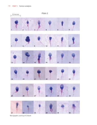 74   PART I Semen analysis



     10 microns
                                     Plate 2




 Micrographs courtesy of C Brazil.
 