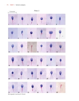 76    PART I Semen analysis



     10 microns
                                     Plate 3




 Micrographs courtesy of C Brazil.
 