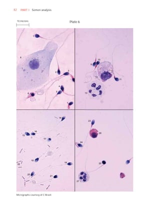 82      PART I Semen analysis


     10 microns                      Plate 6




 Micrographs courtesy of C Brazil.
 