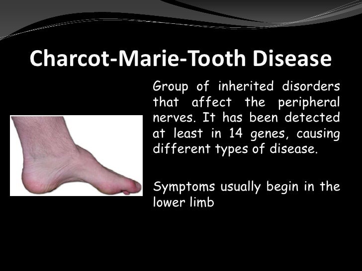 Whole genome sequencing in a patient with charcot-marie-tooth neuropa…