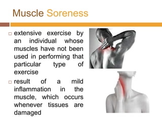 MuscleSorenessextensive exercise by an individual whose muscles have not been used in performing that particular type of exerciseresult of a mild inflammation in the muscle, which occurs whenever tissues are damaged 