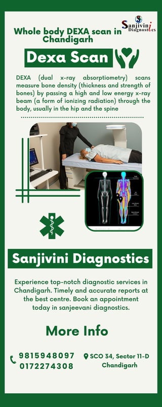 Experience top-notch diagnostic services in
Chandigarh. Timely and accurate reports at
the best centre. Book an appointment
today in sanjeevani diagnostics.
Sanjivini Diagnostics
Whole body DEXA scan in
Chandigarh
DEXA (dual x-ray absorptiometry) scans
measure bone density (thickness and strength of
bones) by passing a high and low energy x-ray
beam (a form of ionizing radiation) through the
body, usually in the hip and the spine
Dexa Scan
More Info
9815948097
0172274308
SCO 34, Sector 11-D
Chandigarh
 