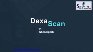 DexaScan
in
Chandigarh
www.sanjivinidiagnostics.com
 