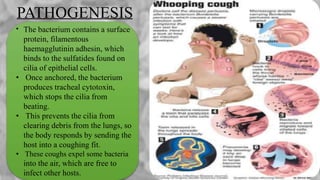 PATHOGENESIS
• The bacterium contains a surface
protein, filamentous
haemagglutinin adhesin, which
binds to the sulfatides found on
cilia of epithelial cells.
• Once anchored, the bacterium
produces tracheal cytotoxin,
which stops the cilia from
beating.
• This prevents the cilia from
clearing debris from the lungs, so
the body responds by sending the
host into a coughing fit.
• These coughs expel some bacteria
into the air, which are free to
infect other hosts.
 