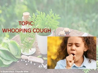 TOPIC:
WHOOPING COUGH
 