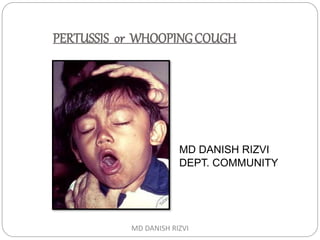 PERTUSSIS or WHOOPINGCOUGH
MD DANISH RIZVI
DEPT. COMMUNITY
MD DANISH RIZVI
 