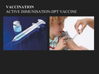 VACCINATION
ACTIVE IMMUNISATION-DPT VACCINE
 