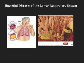 Bacterial Diseases of the Lower Respiratory System
 