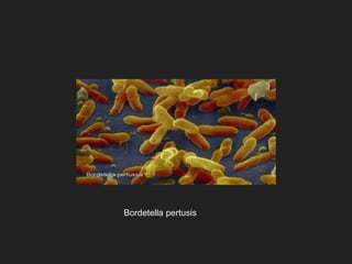 Bordetella pertusis
 