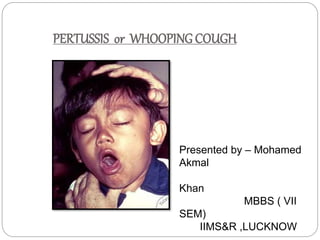 PERTUSSIS or WHOOPING COUGH
Presented by – Mohamed
Akmal
Khan
MBBS ( VII
SEM)
IIMS&R ,LUCKNOW
 