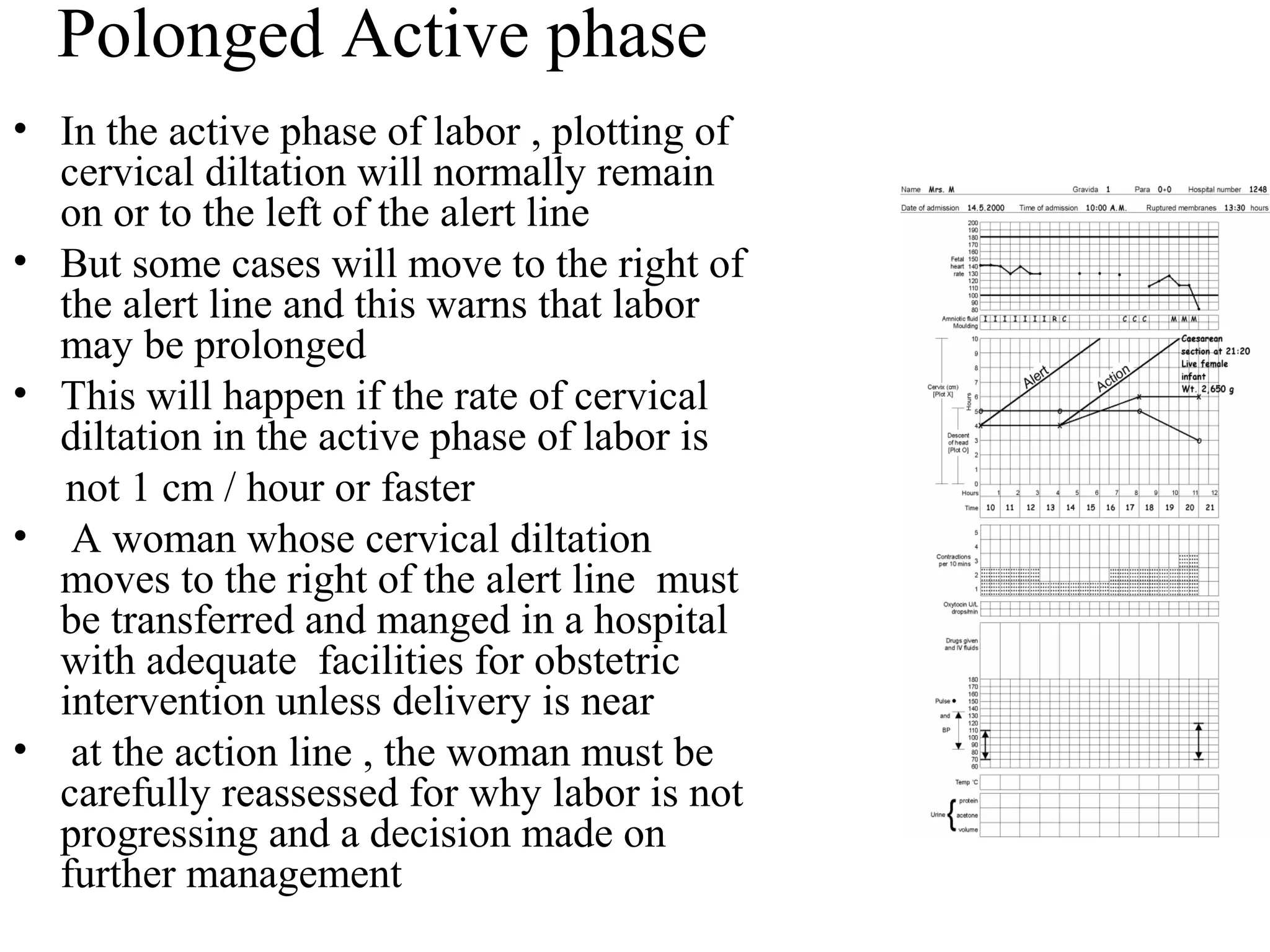 Polonged Active phase
• In the active phase of labor , plotting of
cervical diltation will normally remain
on or to the left of the alert line
• But some cases will move to the right of
the alert line and this warns that labor
may be prolonged
• This will happen if the rate of cervical
diltation in the active phase of labor is
not 1 cm / hour or faster
• A woman whose cervical diltation
moves to the right of the alert line must
be transferred and manged in a hospital
with adequate facilities for obstetric
intervention unless delivery is near
• at the action line , the woman must be
carefully reassessed for why labor is not
progressing and a decision made on
further management
 