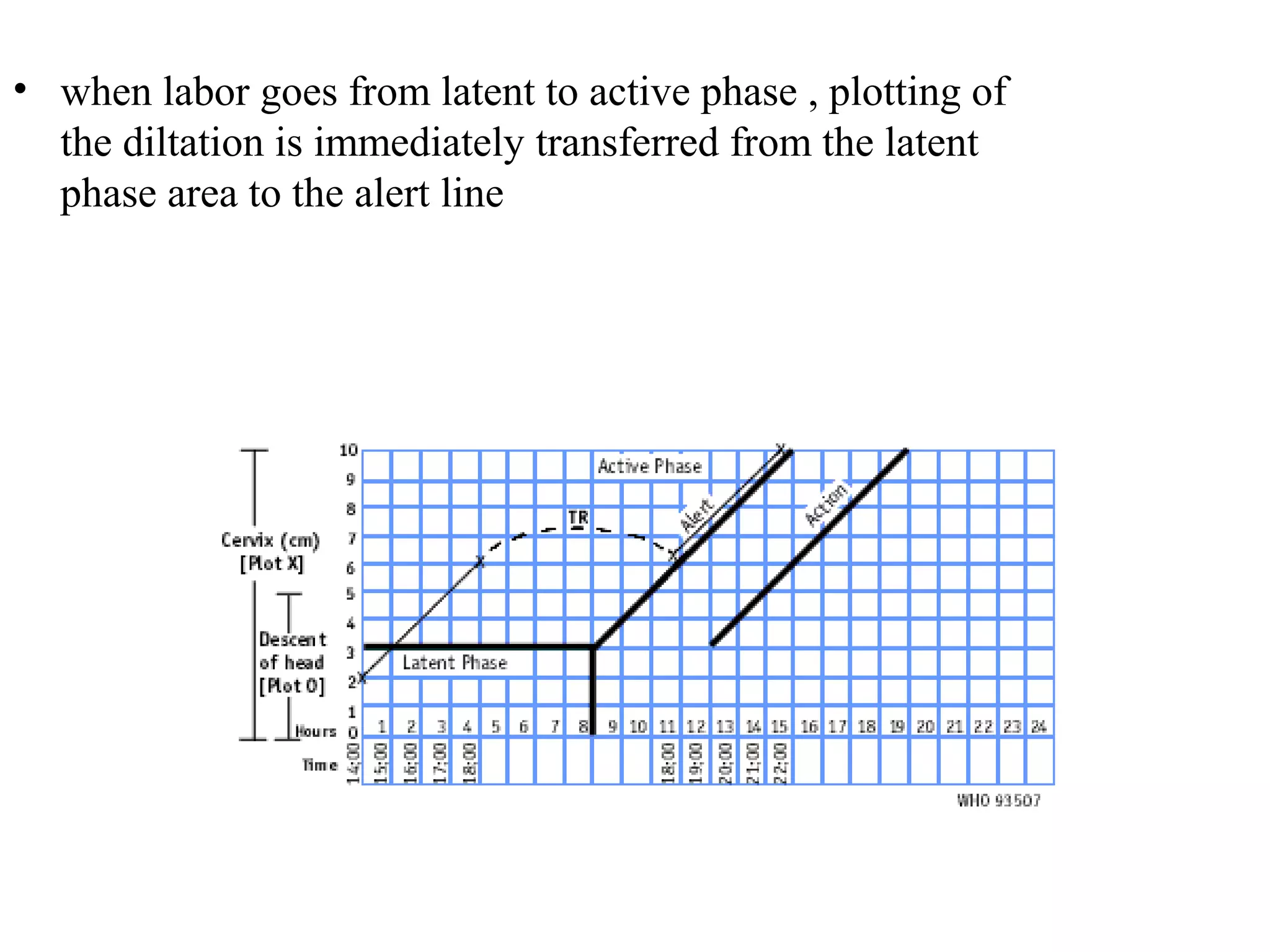 • when labor goes from latent to active phase , plotting of
the diltation is immediately transferred from the latent
phase area to the alert line
 