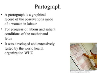 Partograph
• A partograph is a graphical
record of the observations made
of a women in labour
• For progress of labour and salient
conditions of the mother and
fetus
• It was developed and extensively
tested by the world health
organization WHO
 