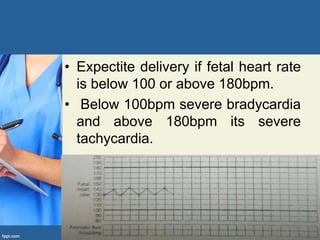• Expectite delivery if fetal heart rate
is below 100 or above 180bpm.
• Below 100bpm severe bradycardia
and above 180bpm its severe
tachycardia.
 