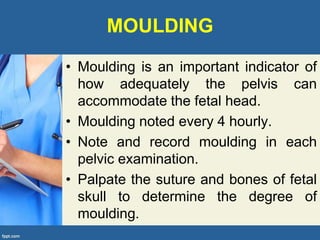 MOULDING
• Moulding is an important indicator of
how adequately the pelvis can
accommodate the fetal head.
• Moulding noted every 4 hourly.
• Note and record moulding in each
pelvic examination.
• Palpate the suture and bones of fetal
skull to determine the degree of
moulding.
 