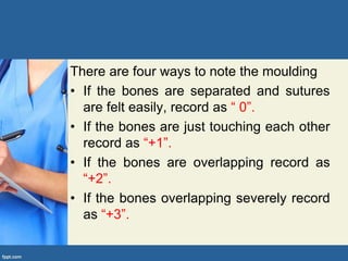 There are four ways to note the moulding
• If the bones are separated and sutures
are felt easily, record as “ 0”.
• If the bones are just touching each other
record as “+1”.
• If the bones are overlapping record as
“+2”.
• If the bones overlapping severely record
as “+3”.
 