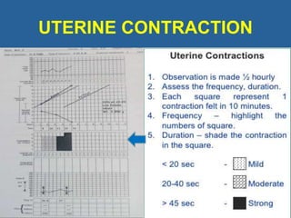 UTERINE CONTRACTION
•
 