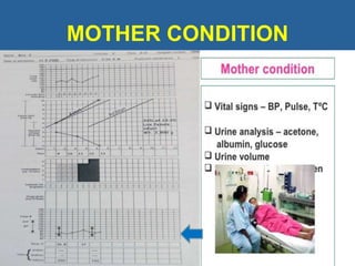 MOTHER CONDITION
 