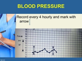 BLOOD PRESSURE
Record every 4 hourly and mark with
arrow
 