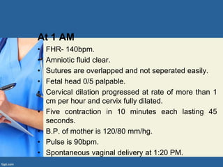 At 1 AM
• FHR- 140bpm.
• Amniotic fluid clear.
• Sutures are overlapped and not seperated easily.
• Fetal head 0/5 palpable.
• Cervical dilation progressed at rate of more than 1
cm per hour and cervix fully dilated.
• Five contraction in 10 minutes each lasting 45
seconds.
• B.P. of mother is 120/80 mm/hg.
• Pulse is 90bpm.
• Spontaneous vaginal delivery at 1:20 PM.
 