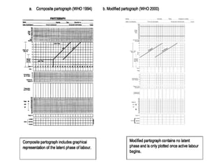 Partogramme Who Who partograph | PPT