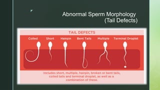 WHO Semen Analysis, sampling comparison. | PPTX