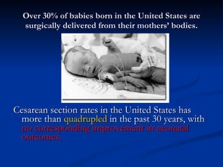 Over 30% of babies born in the United States are surgically delivered from their mothers’ bodies. Cesarean section rates in the United States has more than  quadrupled  in the past 30 years, with  no corresponding improvement in neonatal outcomes. 