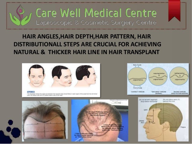 Care Well Medical Center Cosmetic Treatment Hair Transplant Clinic