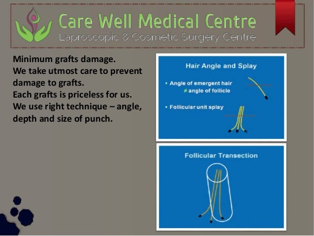 care well medical centre hair & skin clinic