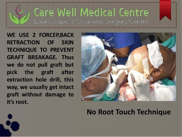 care well medical centre hair & skin clinic
